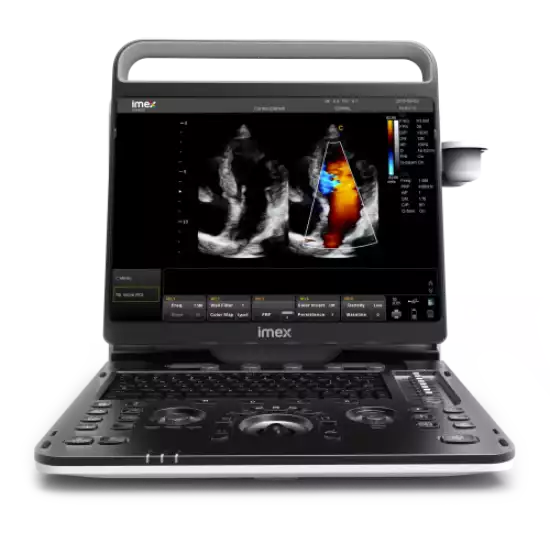 Ultrassom I5