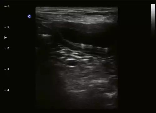 E5 VET