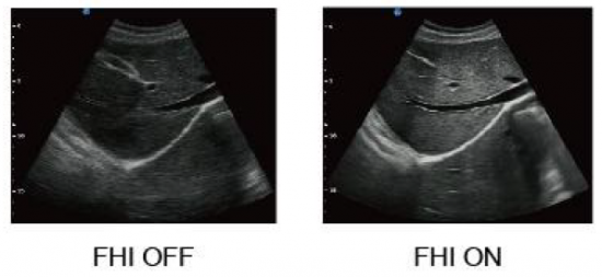 FHI