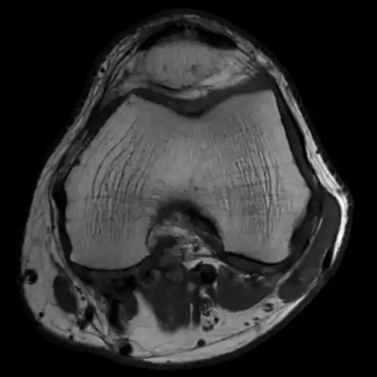Body Imaging