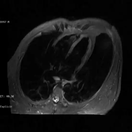 MSK Imaging
