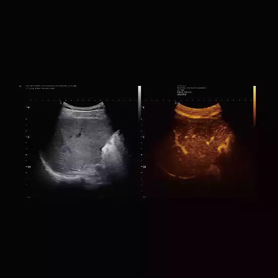 SonoContrast