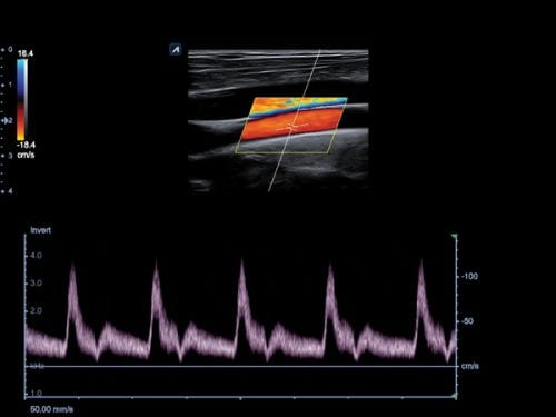 ImexMedical-eCube-clinica-36