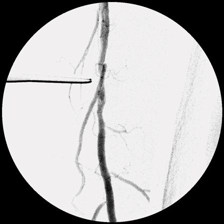 ImexMedical - UniquePremium-Clínica - 10