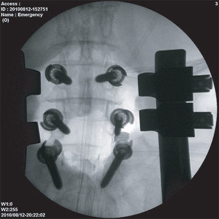 ImexMedical - UniquePremium-Clínica - 14