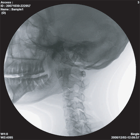 ImexMedical - UniquePremium-Clínica - 15