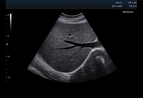 1-1_SC1-4HS_Liver_수정본