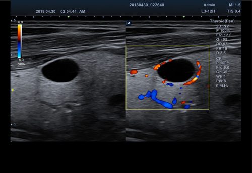 1-3_Thyroid_Dual