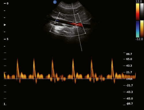 Canine Aorta, PW Mode