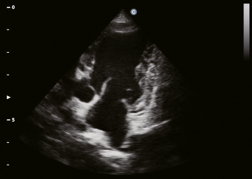 Canine Cardiac, B Mode