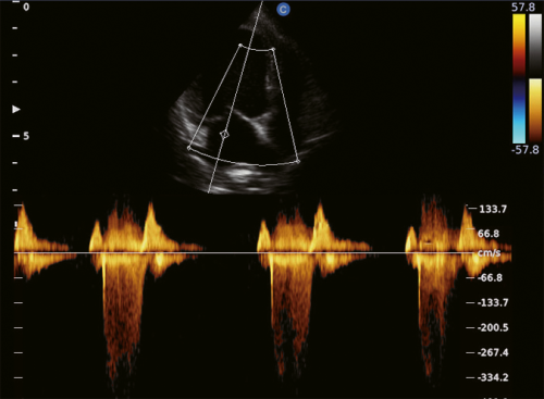 Canine Cardiac, CW Mode