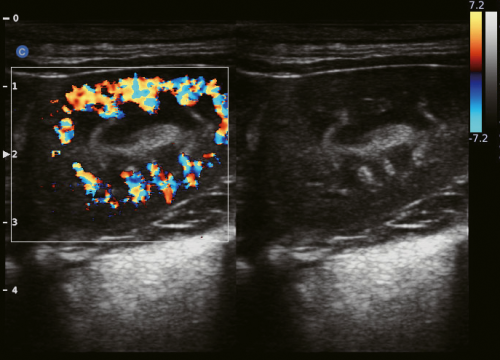 Canine Kidney, B-BC Mode