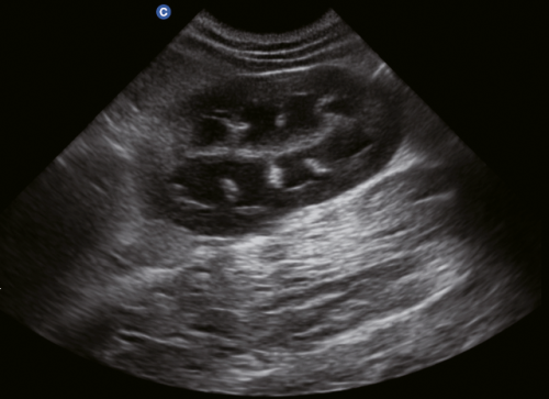 Canine Kidney, B Mode