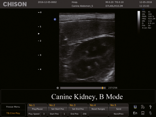 Canine kidney, B Mode