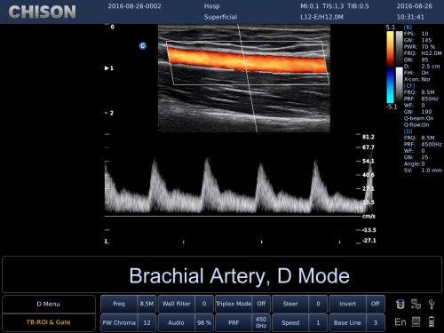 23(Brachial,D)