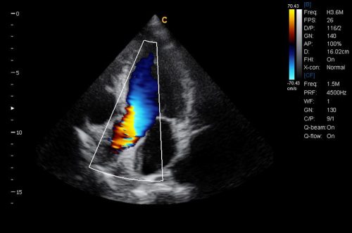 cardiac-c