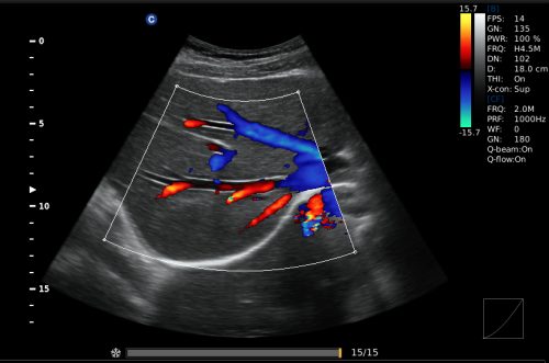 liver,C
